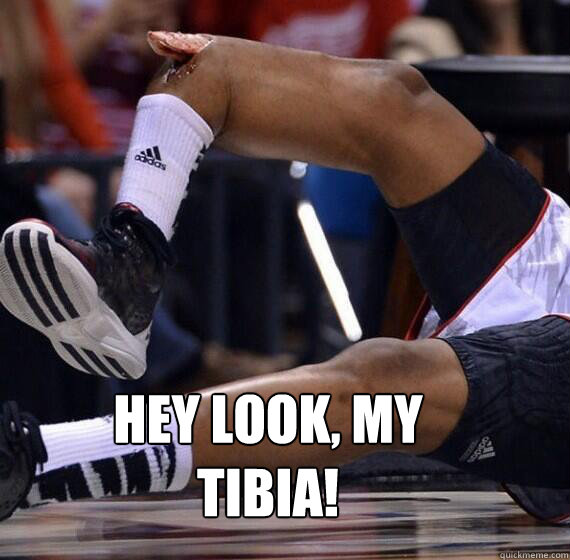 Hey look, my tibia! - Hey look, my tibia!  Kevin Ware