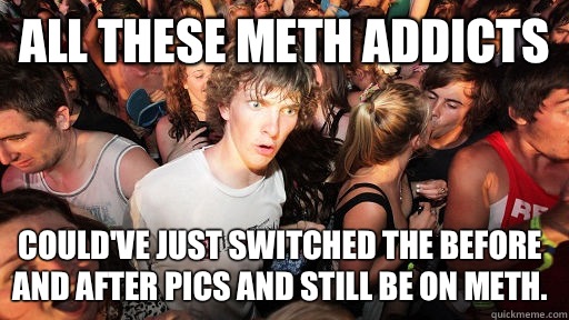 All these meth addicts Could've just switched the before and after pics and still be on meth.  Sudden Clarity Clarence
