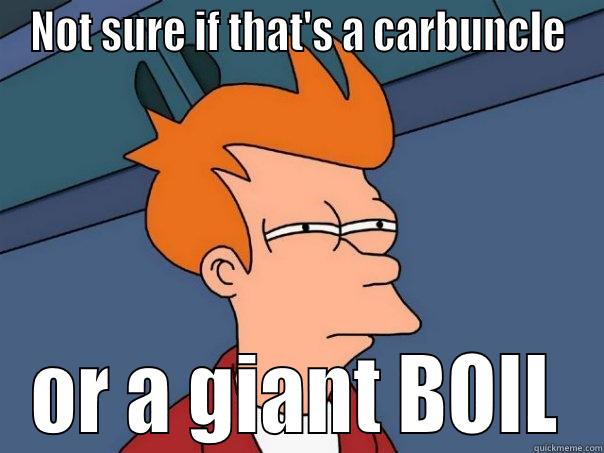 NOT SURE IF THAT'S A CARBUNCLE OR A GIANT BOIL Futurama Fry