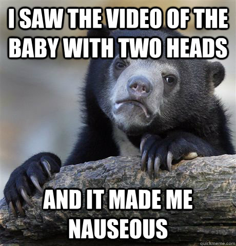 I saw the video of the baby with two heads and it made me nauseous   Confession Bear