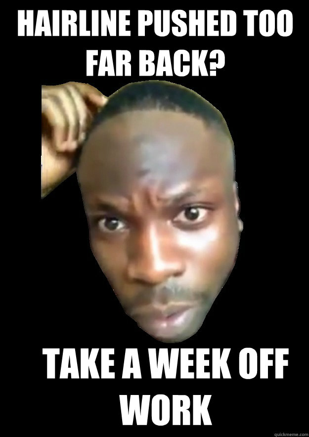 Hairline pushed too far back? Take a week off work  Week Off Work