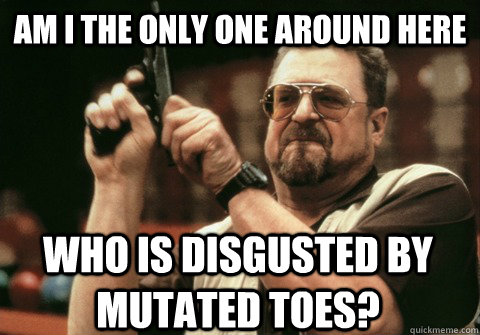 Am I the only one around here who is disgusted by mutated toes? - Am I the only one around here who is disgusted by mutated toes?  Am I the only one