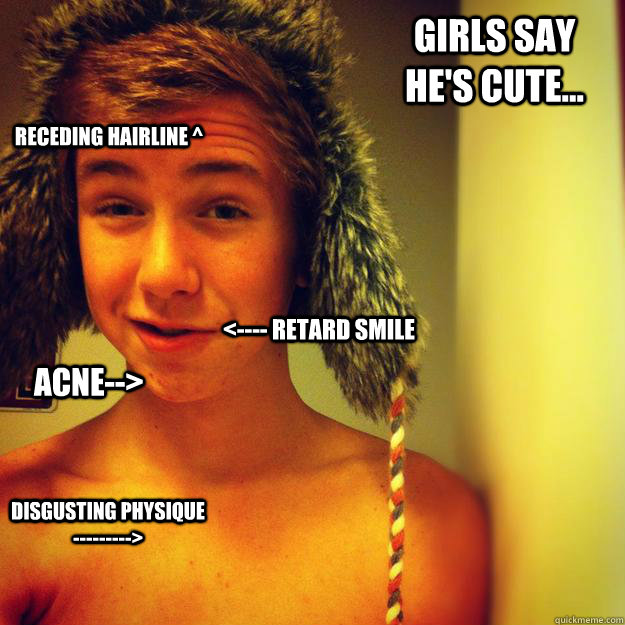 Girls say he's cute... Acne--> disgusting physique  ---------> Receding hairline ^ <---- retard smile - Girls say he's cute... Acne--> disgusting physique  ---------> Receding hairline ^ <---- retard smile  Pat McCarty