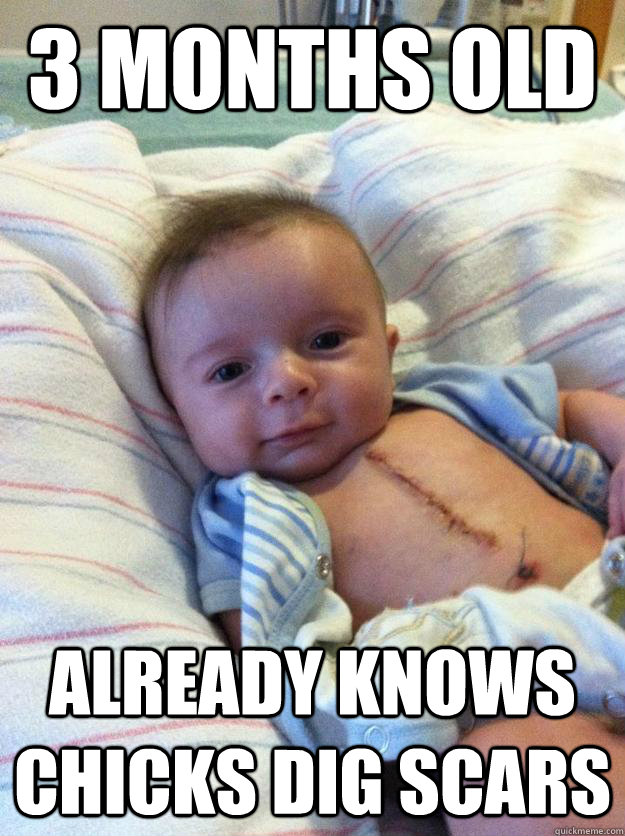 3 months old Already knows chicks dig scars  Ridiculously Goodlooking Surgery Baby