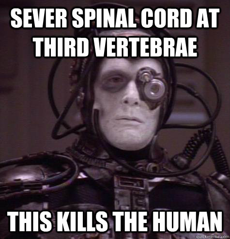 Sever spinal cord at third vertebrae this kills the human - Sever spinal cord at third vertebrae this kills the human  Crosis