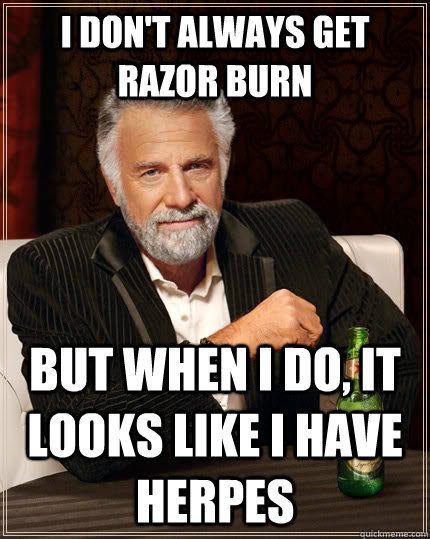 I don't always get razor burn but when i do, it looks like i have herpes  The Most Interesting Man In The World