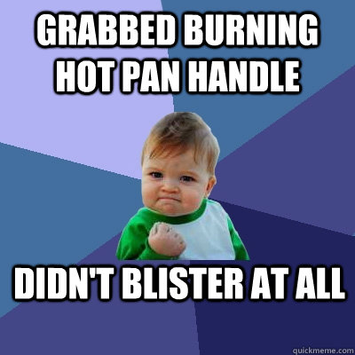 Grabbed Burning hot pan handle Didn't blister at all - Grabbed Burning hot pan handle Didn't blister at all  Success Kid