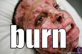  BURN Misc