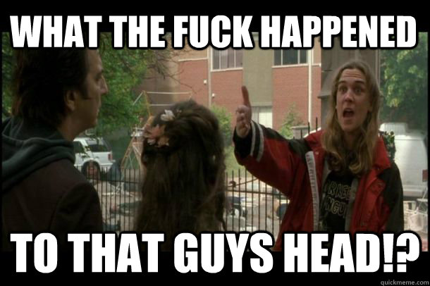 What the fuck happened to that guys head!? - What the fuck happened to that guys head!?  Misc