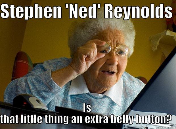 STEPHEN 'NED' REYNOLDS  IS THAT LITTLE THING AN EXTRA BELLY BUTTON?  Grandma finds the Internet