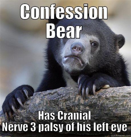 CONFESSION BEAR HAS CRANIAL NERVE 3 PALSY OF HIS LEFT EYE Confession Bear