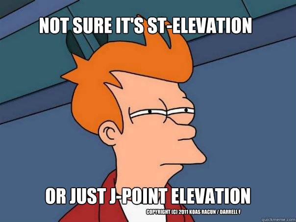 Not sure it's ST-elevation Or just J-point elevation Copyright (C) 2011 Koas Racun / Darrell F  Futurama Fry