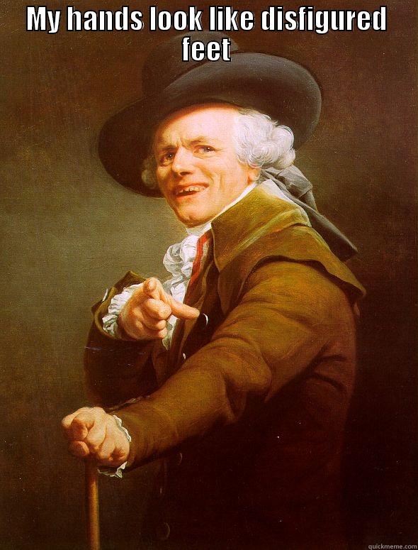 MY HANDS LOOK LIKE DISFIGURED FEET  Joseph Ducreux