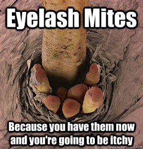 Eyelash Mites Because you have them now and you're going to be itchy  Eyelash Mites