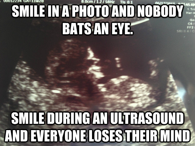 Smile in a photo and nobody bats an eye. smile during an ultrasound and everyone loses their mind - Smile in a photo and nobody bats an eye. smile during an ultrasound and everyone loses their mind  Misc