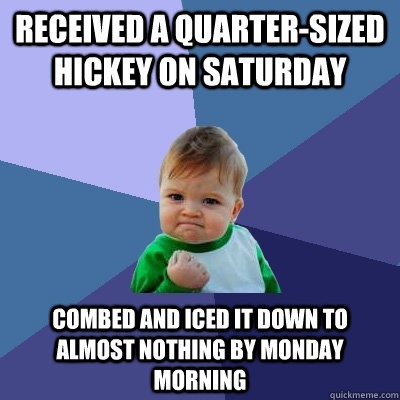 Received a Quarter-Sized Hickey on Saturday Combed and Iced it down to almost nothing by Monday Morning  Success Kid
