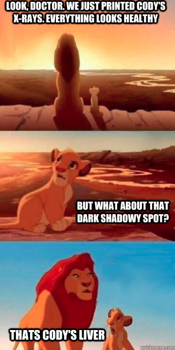 Look, doctor. we just printed cody's x-rays. everything looks healthy  but what about that dark shadowy spot? thats cody's liver - Look, doctor. we just printed cody's x-rays. everything looks healthy  but what about that dark shadowy spot? thats cody's liver  Lion King Potsdam