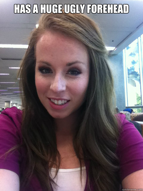 HAS A HUGE UGLY FOREHEAD  - HAS A HUGE UGLY FOREHEAD   Rediculously Photogenic Girl