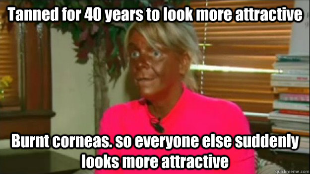 Tanned for 40 years to look more attractive Burnt corneas. so everyone else suddenly looks more attractive  - Tanned for 40 years to look more attractive Burnt corneas. so everyone else suddenly looks more attractive   Excessive Tanning Mom