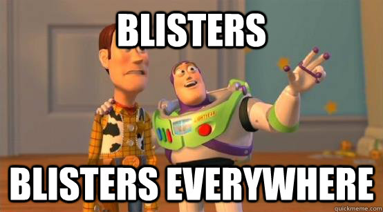 Blisters Blisters everywhere  Buzz Glitter