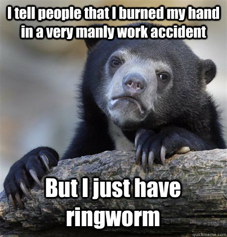 I tell people that I burned my hand in a very manly work accident But I just have ringworm  Confession Bear
