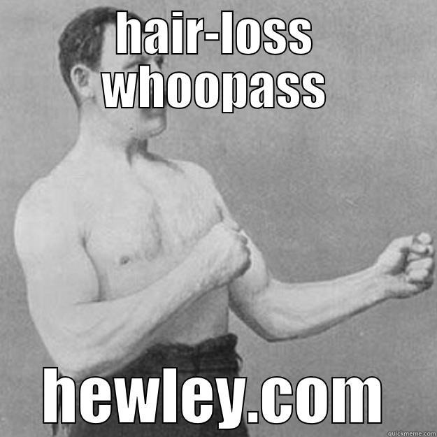 HAIR-LOSS WHOOPASS HEWLEY.COM overly manly man