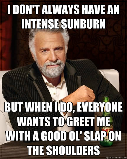 I don't always have an intense sunburn but when I do, everyone wants to greet me with a good ol' slap on the shoulders  The Most Interesting Man In The World