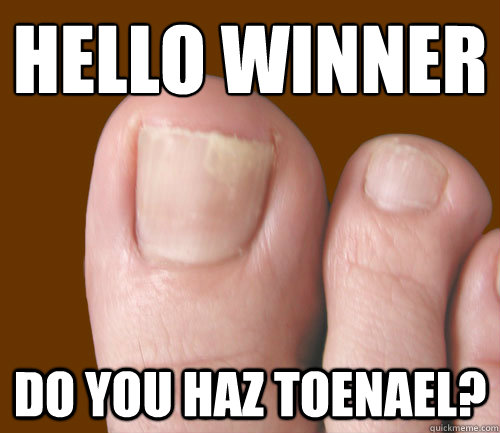 HELLO WINNER DO YOU HAZ TOENAEL?  