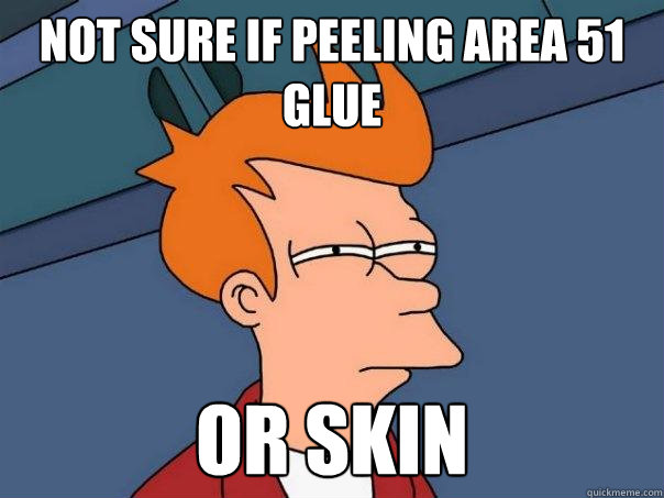 Not sure if peeling area 51 glue or skin  Futurama Fry