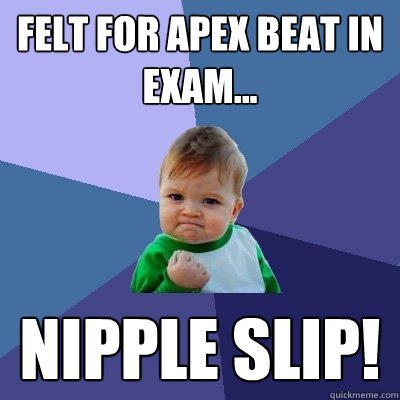 Felt for apex beat in exam... Nipple SLIP!  Success Kid